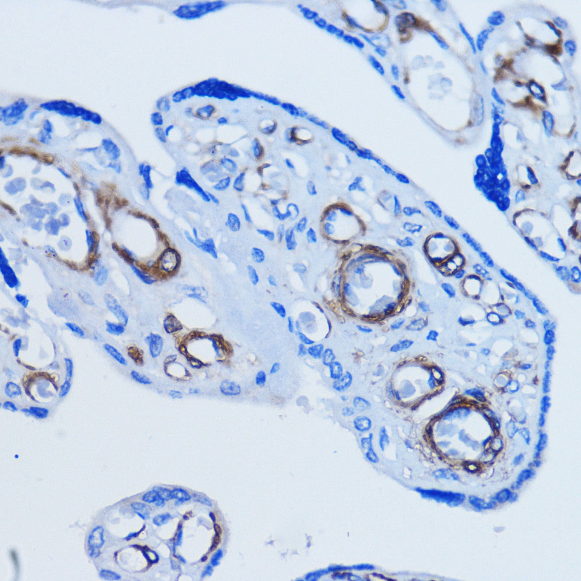 ACTA2 antibody