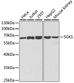 SGK1 Antibody