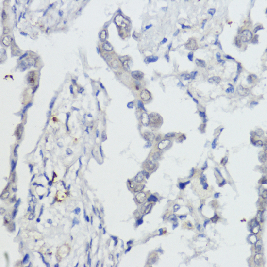 pan-AKT antibody