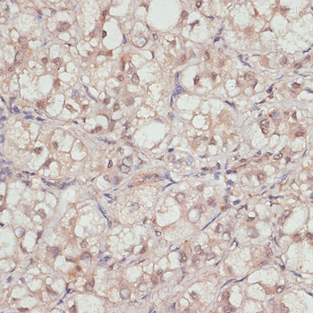 YAP1 Rabbit Polyclonal Antibody