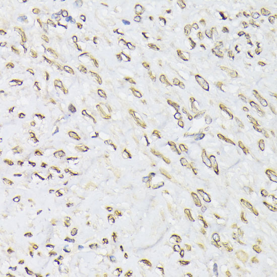 EMD Antibody