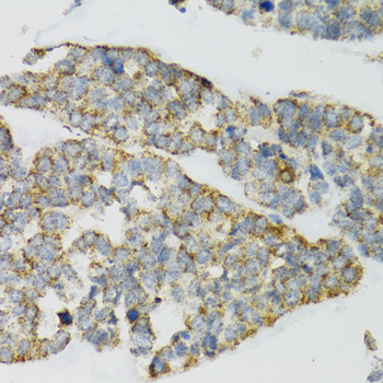 PI3 Polyclonal Antibody