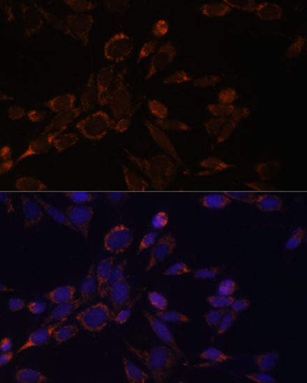 ACAT1 Antibody