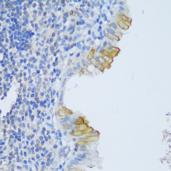 CRACR2A Polyclonal Antibody