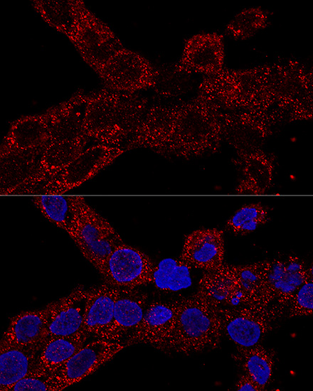 RPL21 Polyclonal Antibody