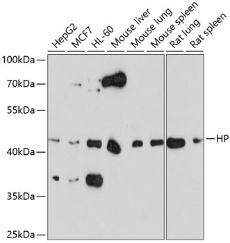 HP Antibody