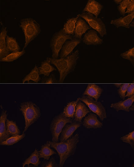 ATXN2 Polyclonal Antibody