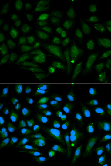 DCN Antibody