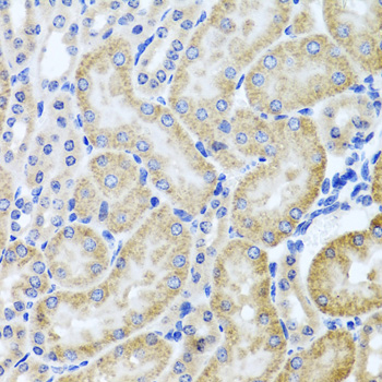 HDAC6 Antibody