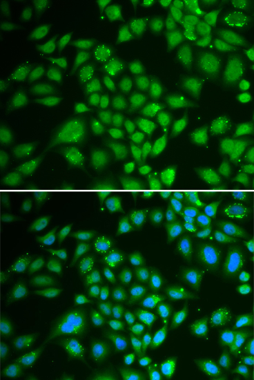 DCK Antibody