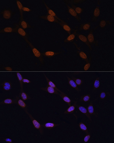 LMNB1 Antibody