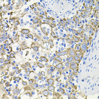 ACVR2A antibody