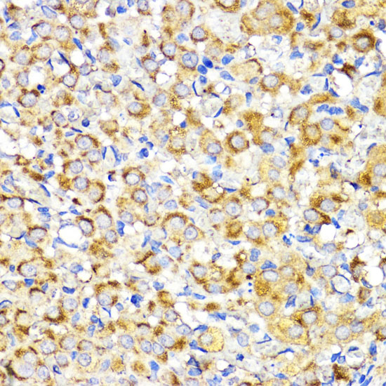 BMPR1B Antibody