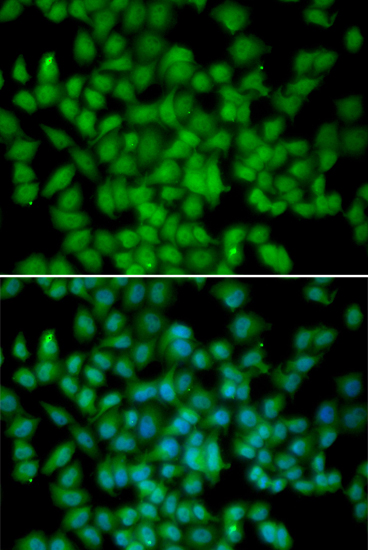 CDKN2C antibody