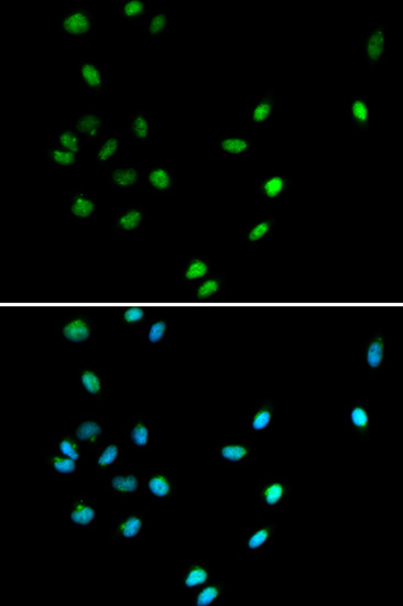 RUNX1 Antibody