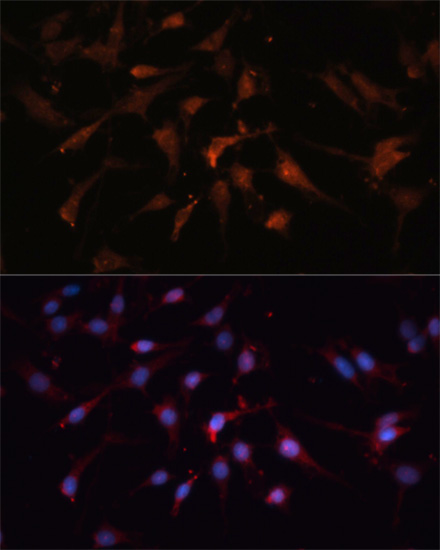 GSK3B antibody