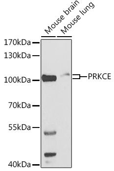 PRKCE Antibody