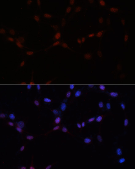 SUMO1 Antibody