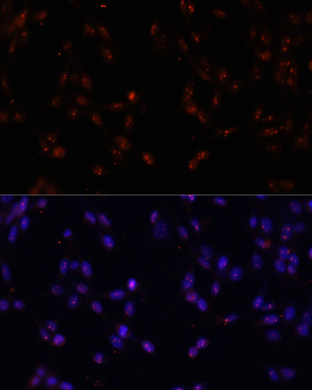 ILF3 antibody