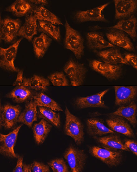 RPS3 Antibody