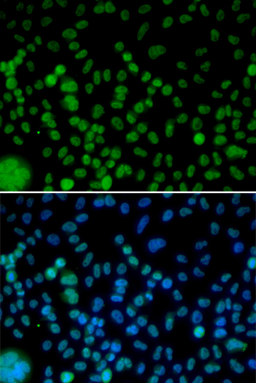 IRF2 antibody