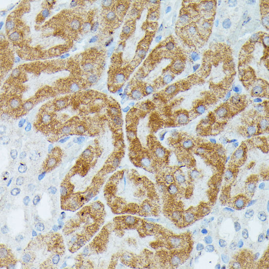 MEF2C Antibody