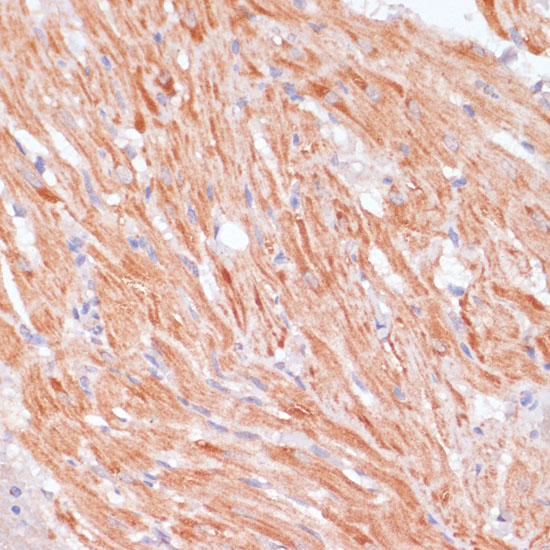 CASP9 antibody