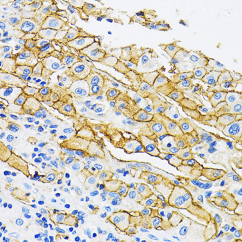 SLC16A1 antibody