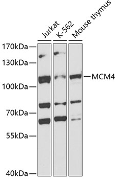 MCM4 antibody