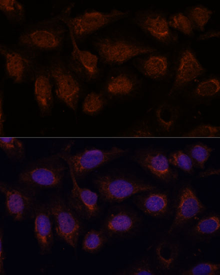 PPP2CB antibody