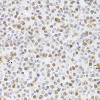 TP53 antibody