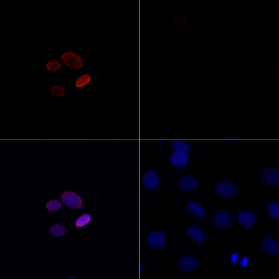 Acetyl-Histone H4-K16 pAb