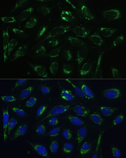 HSD17B10 Antibody