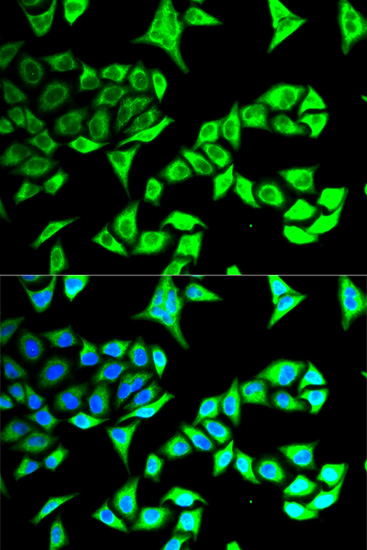 GABARAP Antibody