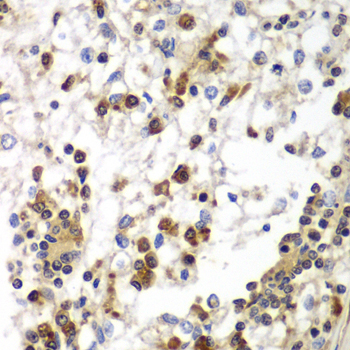 SND1 antibody