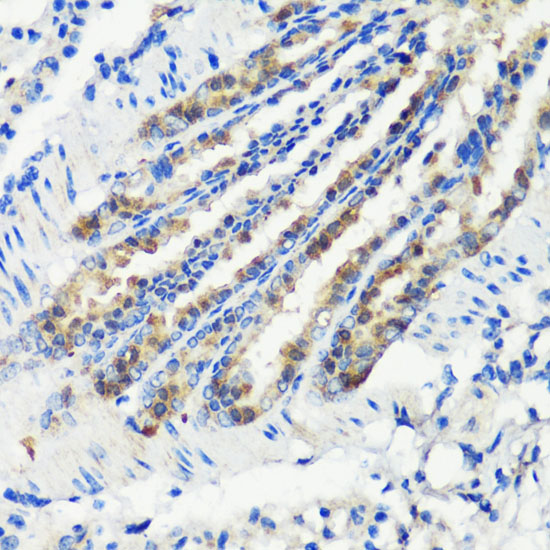 MLL5 antibody