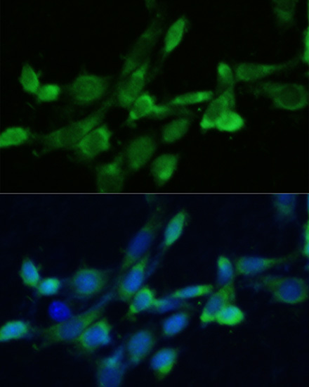 FDFT1 antibody