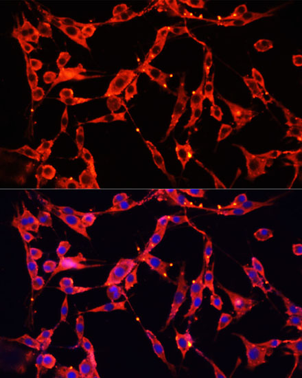 AOC1 antibody