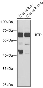 BTD antibody