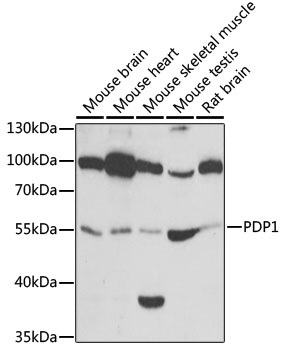 PDP1 antibody