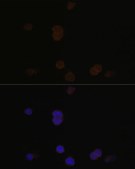 RCVRN antibody