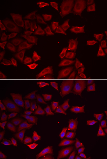 SEPHS1 antibody