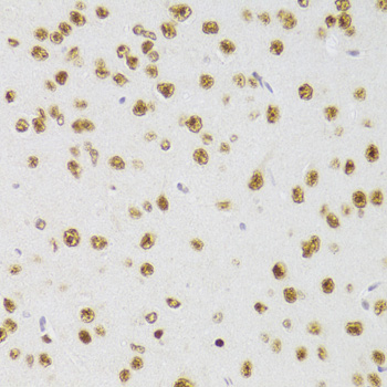 CSRP3 antibody