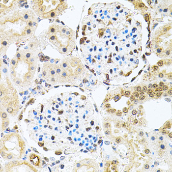 PNKP antibody