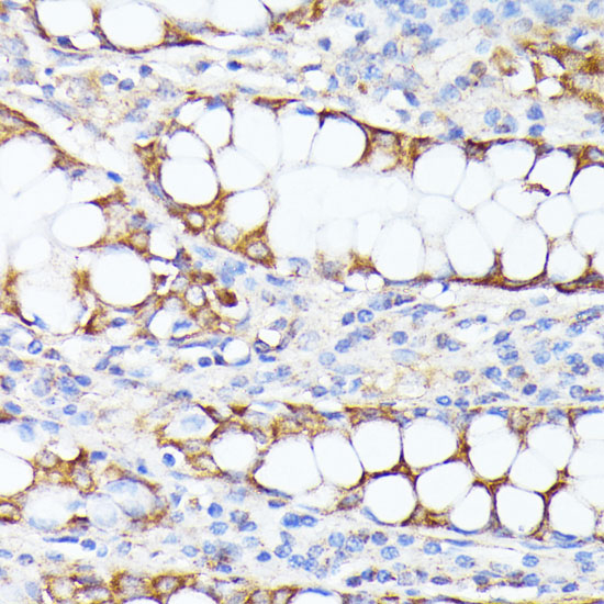 SMYD4 antibody