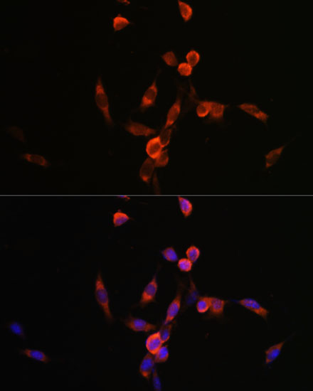 PIK3CA antibody