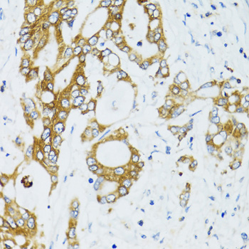 SIRT2 Antibody