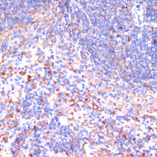 VHL Antibody