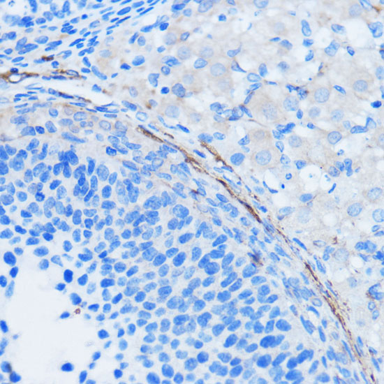 ACTA2 antibody