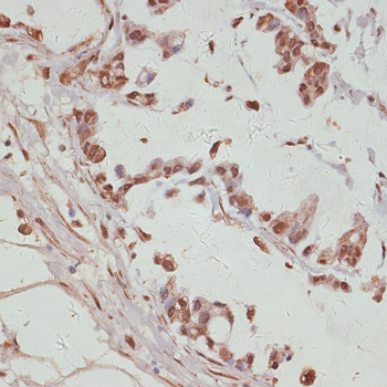 YAP1 Rabbit Polyclonal Antibody